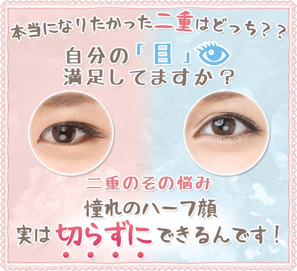 二重のその悩み 憧れのハーフ顔 実は切らずにできるんです!